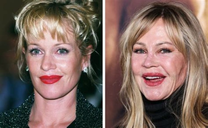 Before And After Plastic Surgery Revelations