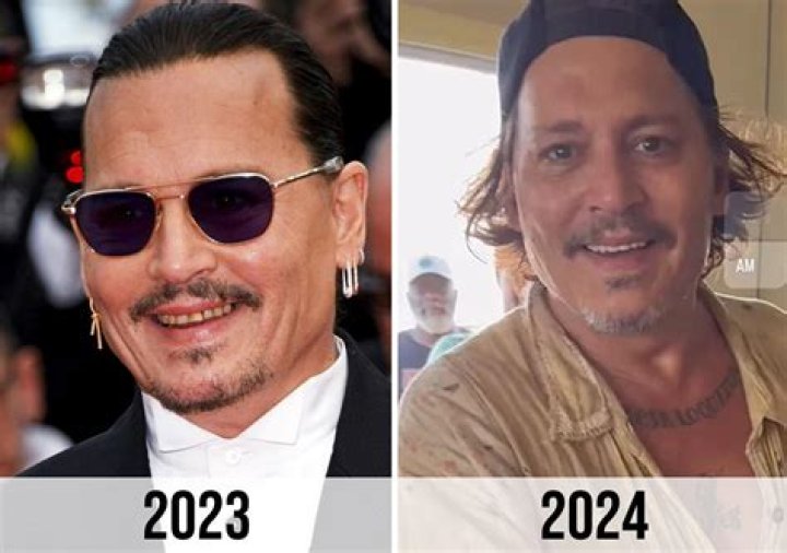 Did Amber Heard, Johnny Depp get plastic surgery? Dr Anthony Youn's viral take on stars' looks