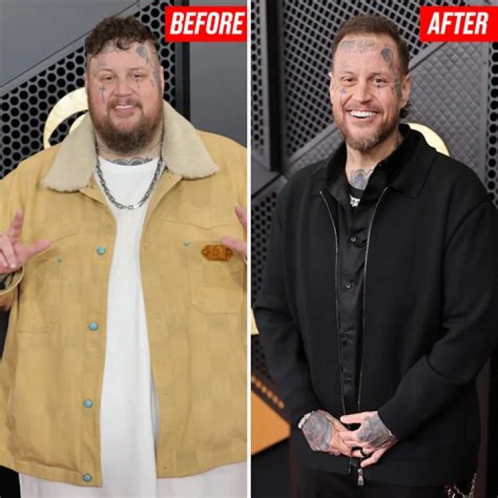 Kane Bling Empire Before Plastic Surgery Photos Compared To After -How Much Did He Change