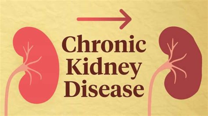 What Happened To Her? Illness & Kidney Disease
