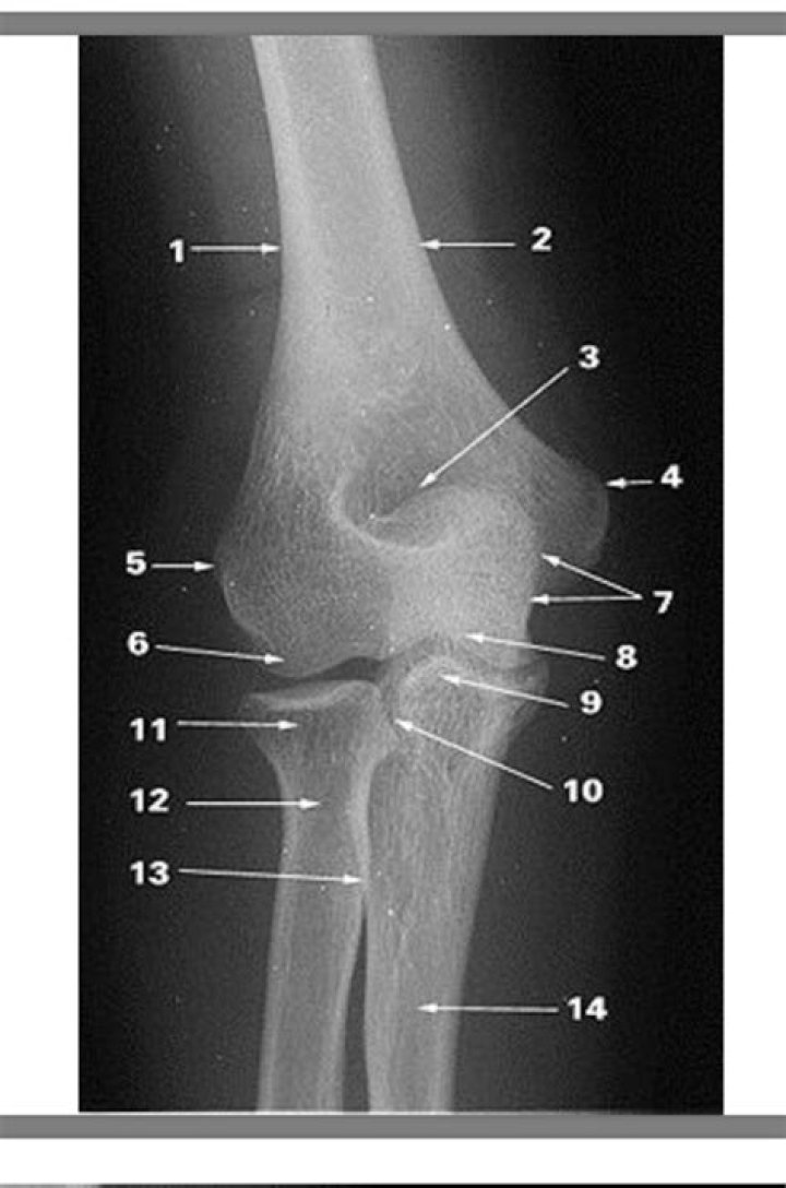 ZestW | Humerus Elbow Labeling Quiz